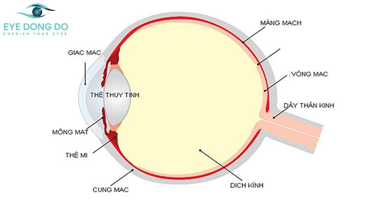 Hình ảnh mô tả vị trí của dịch kính và võng mạc