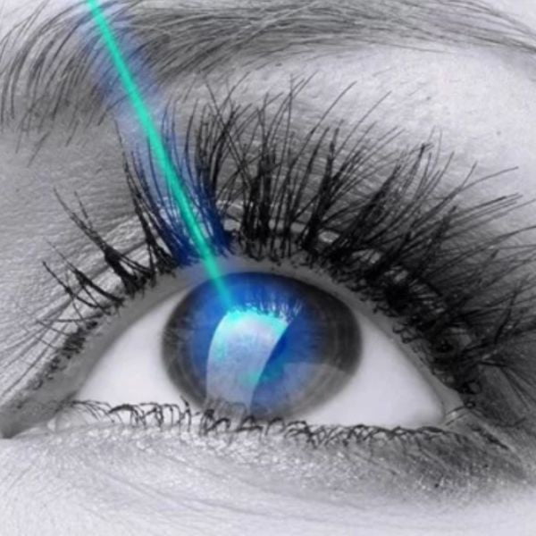 Mổ mắt công nghệ mới với phương pháp lasik 