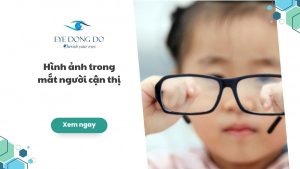 Hình ảnh trong mắt người cận thị sẽ hiển thị như thế nào?