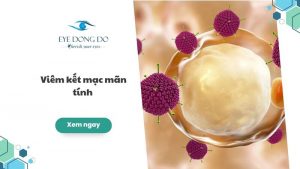 Viêm kết mạc mãn tính là gì