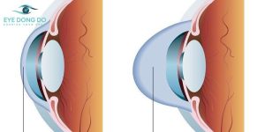 Thăm khám bệnh lý nhãn khoa tại Mắt Đông Đô