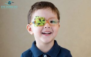 Điều trị nhược thị ở trẻ em bằng phương pháp che mắt