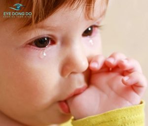 Đau mắt đỏ ở trẻ em và những ba mẹ cần lưu ý khi chữa cho trẻ